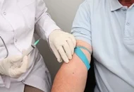 Rolul tratamentului PRP in transplantul de par