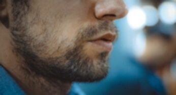 Cum se realizeaza implantul de barba?